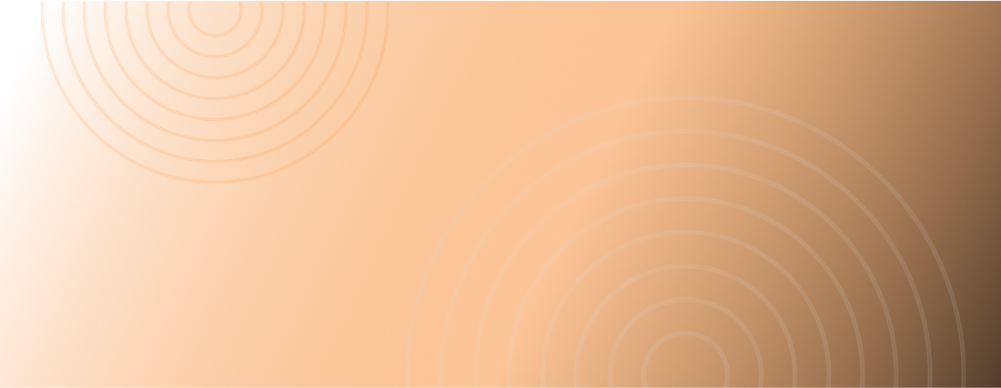 Struggling to Select the Best Experts from a Staff Augmentation Company?